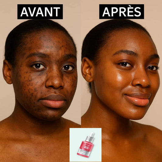 Sérum niacinamide anti tâche